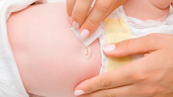 Tedavi gerektirmeyen bebeklerde göbek fıtığı durumlarında bebeğinizi rahatlatabilmek için yapabilecekleriniz şunlar: