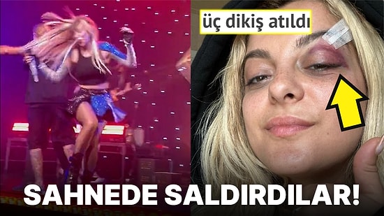 Hayranları Tarafından Saldırıya Uğrayarak Şöhret Sahibi Olmanın Sillesini Ağır Bir Şekilde Yemiş Ünlü İsimler