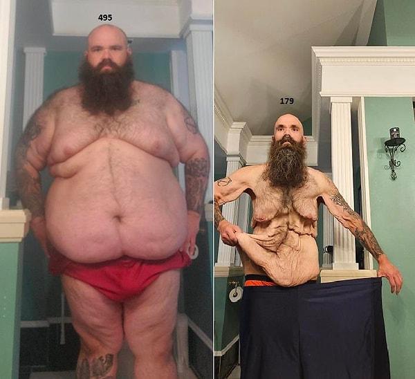 1. "24 ayda 145 kilo vermek işte böyle görünüyor"