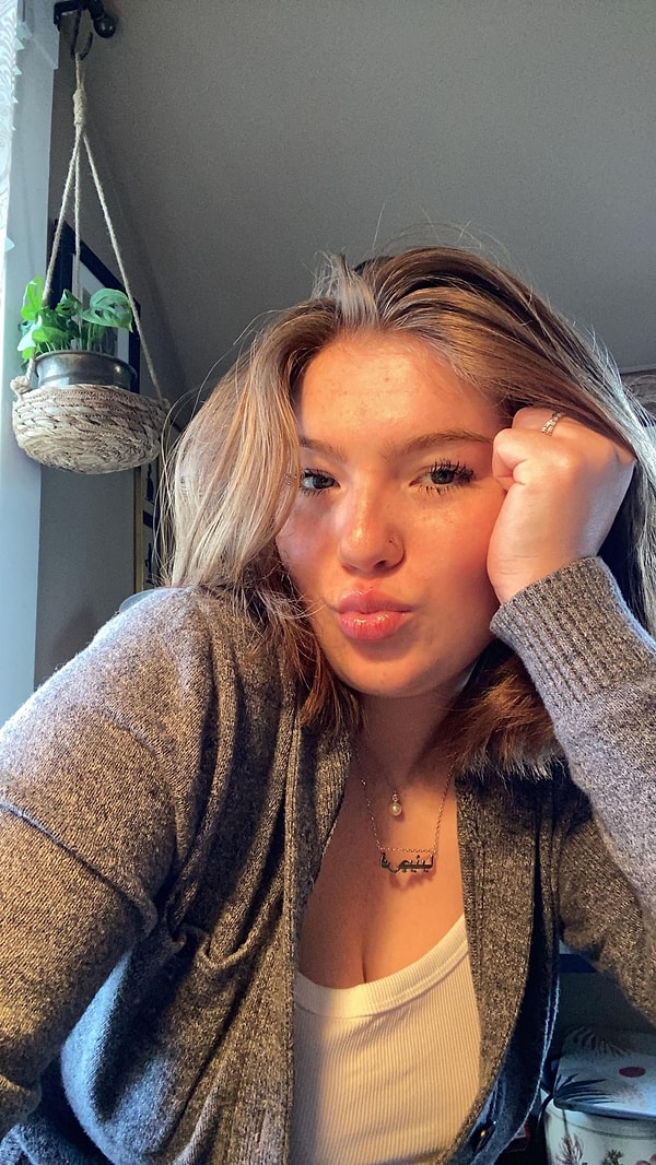 «Все началось с того, что мои глаза сильно зудели и слезились, но я подумала, что это сезонная аллергия».