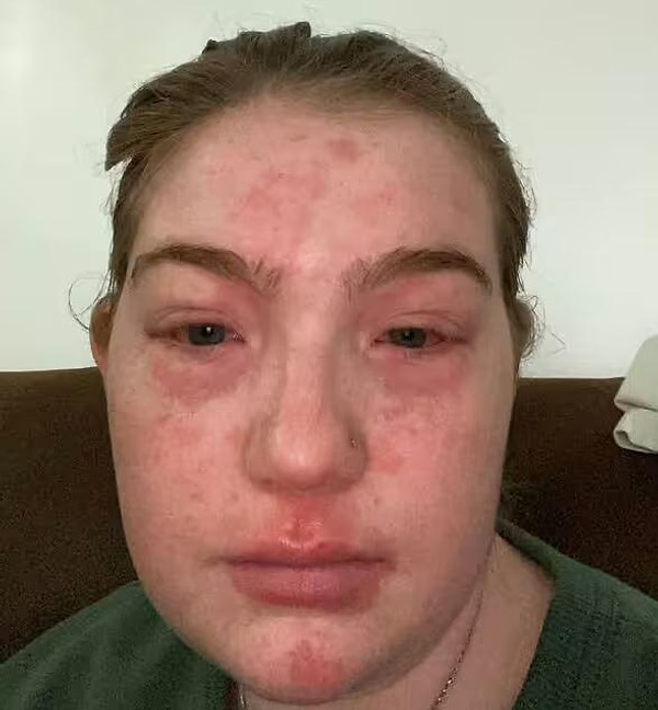 «Он был очень терпелив и поддерживал во всем, и он был так же удивлен, как и я», — рассказывает Вирджиния о преданности своего парня.