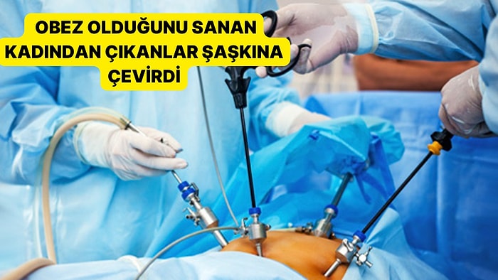 Tıp Dünyası Hayret İçinde: Obez Olduğunu Sanan Kadından Çıkanlar Şaşkına Çevirdi