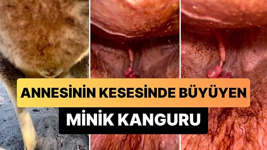 Daha Önce Hiç Annesinin Kesesinde Büyüyen Yavru Bir Kanguru Görmüş müydünüz?