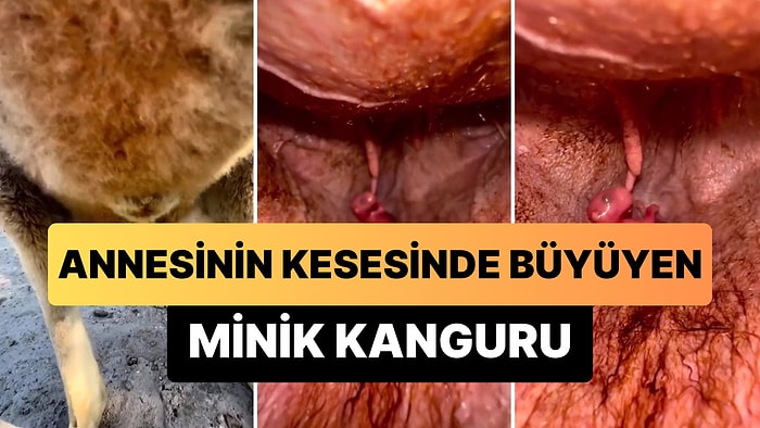 Daha Önce Hiç Annesinin Kesesinde Büyüyen Yavru Bir Kanguru Görmüş müydünüz?