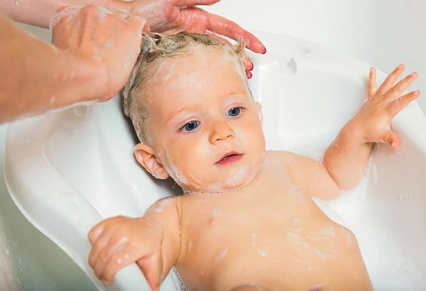 Konak problemi yaşayan bebeklerin saç derisinde pullanma görülebiliyor. Bu pullanmanın nedeni bebeğin saç derisinin kuruluğu.