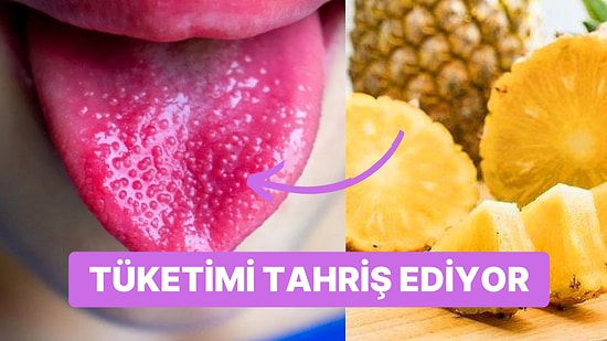 Tropikal Lezzet Ananası Yerken Aslında Dilinize İğneler Batırdığını Biliyor muydunuz?