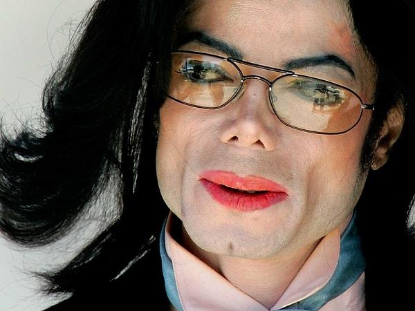 9. Dünyaca ünlü şarkıcı Michael Jackson'ın hastalığının adı nedir?