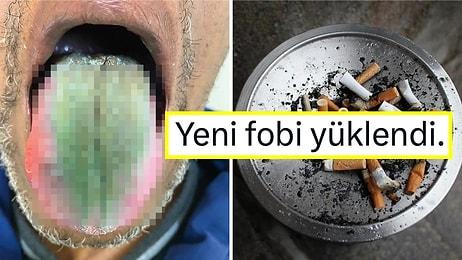 Antibiyotik Kullanırken Sigara İçtikten Sonra Dili Yeşile Dönen ve Kıl Çıkan Adamın İlginç Hikayesi