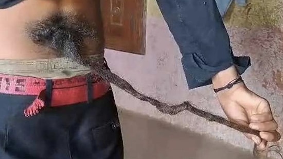 Hindistan’da Belinde 60 cm’lik Kuyruk Çıkan Çocuğu ’Tanrı’ İlan Ettiler