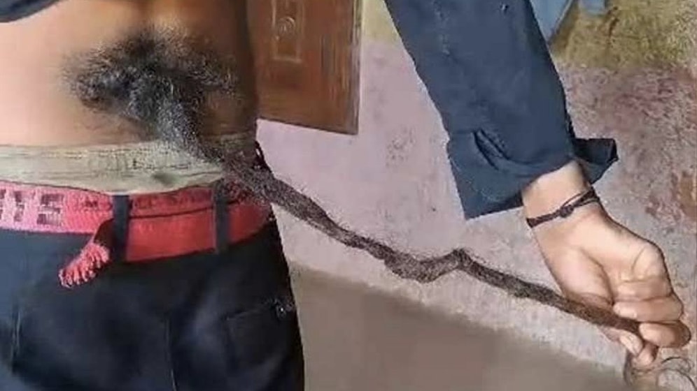 Hindistan’da Belinde 60 cm’lik Kuyruk Çıkan Çocuğu ’Tanrı’ İlan Ettiler