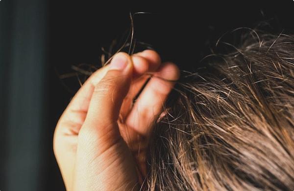 Trikotillomani, yani saç yolma hastalığı kişide psikolojik stres yaratan olaylar esnasında ya da sonrasında, kişinin sürekli olarak saç tellerini yolarak kendisine zarar verme davranışı göstermesidir.