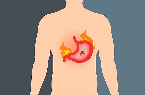 Ancak, mide asidinin aşırı üretimi veya mide asidinin yemek borusuna geri kaçması (reflü) gibi durumlar sindirim sistemi rahatsızlıklarına yol açabilir.