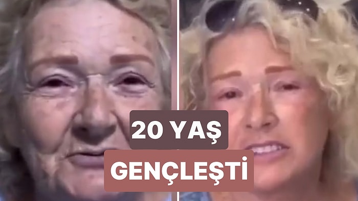 Estetikle 20 Yaş Birden Gençleşen Kadının Muazzam Değişimi
