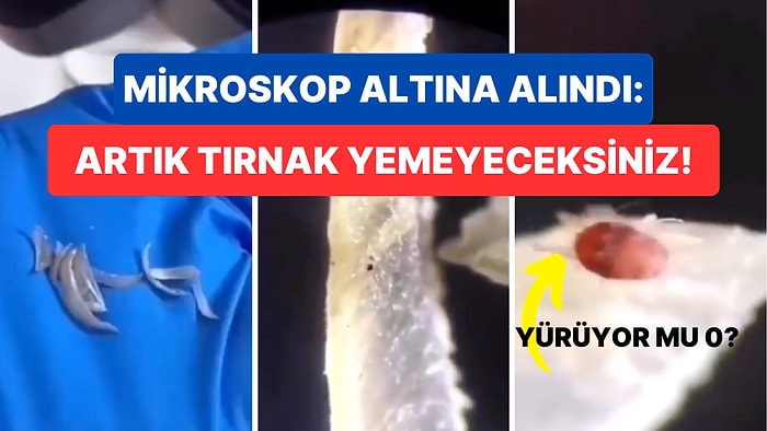 Tırnak Yiyenler İzlesin: Mikroskop Altında İncelenen Tırnak Görüntüsü Midenizi Bulandırabilir