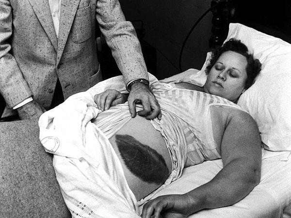 Göktaşının bir insana çarptığına dair doğrulanmış tek bir kayıt var. 1954 yılında ABD'de bir kadına 9 kiloluk göktaşı çarptığı biliniyor. Bu göktaşı evin tavanını delerek kadının üzerine düşmüştü.