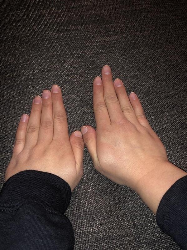 6. "Kız arkadaşımın birbirinden farklı iki eli var."