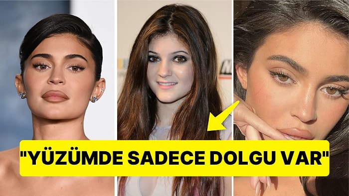 Reality Şovun Kraliçesi Kylie Jenner 'Yüzümde Estetik Yok' Diyince Eski Halini Bi' Araştırdık!