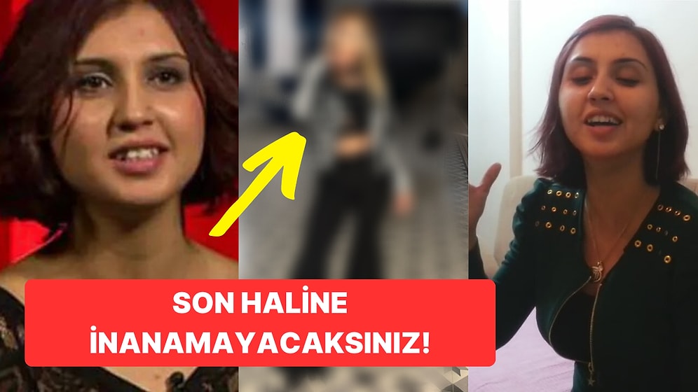 Acun Ilıcalı'nın O Ses Türkiye'den Diskalifiye Ettiği Nur Cennet Uçar'ın Son Halini Tanıyamayacaksınız!
