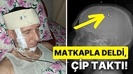 Rusya'da Bir Vatandaş Rüyalarını Kontrol Edebilmek İçin Matkapla Başını Delip Çip Taktı!
