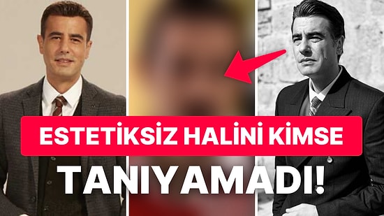 Ömer Dizisinin Erdal'ı Tayanç Ayaydın'ın Estetik Yaptırmadan Önceki Hali Ortaya Çıktı: Görenler Şok Oldu!
