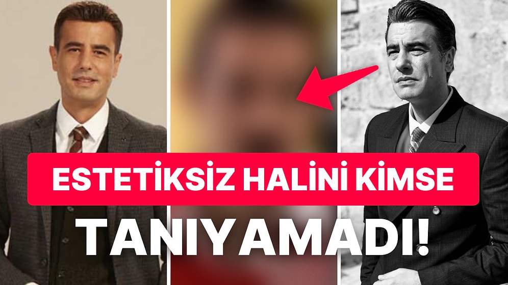 Ömer Dizisinin Erdal'ı Tayanç Ayaydın'ın Estetik Yaptırmadan Önceki Hali Ortaya Çıktı: Görenler Şok Oldu!