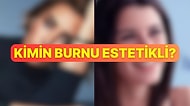 Bakalım Burnunda Estetik Olan Ünlülerden Kaçını Doğru Tahmin Edeceksin?
