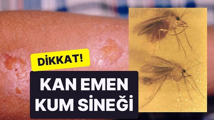 Dikkat! Kan Emen Kum Sineği Tehlikesi: "Sivrisinekle Mücadele Etmekten Daha Zor”