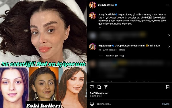 Son olarak 2. Sayfa programının Instagram hesabında kendi fotoğrafını "Her ne kadar estetik deseler de..." açıklamasıyla görünce bi' miktar sinirlenen Özge Ulusoy "Durup durup sarmasanız mı 😂 Hobi oldum" şeklinde yorumda bulundu.