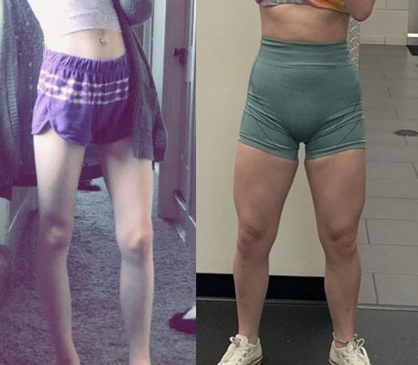 4. "1.5 yıl ve 20 kilo aldıktan sonra baldırlarımdaki değişim!"