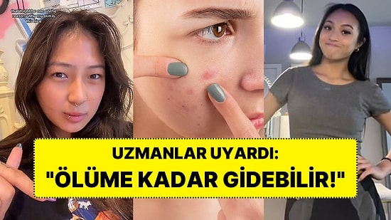 TikTok’ta Kullanıcılara Sivilceleri İçin Siyanür İçeren Cilt Bakımı Rutini Öneren Yeni Akım İnfial Yarattı