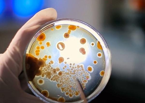 Hakemli bilimsel dergi 'Emerging Infectious Diseases'te yayımlanan makalede, talihsiz adamın ellerinde meydana gelen enfeksiyonun sebebi daha önce bilinmeyen bir tür bakteriden kaynaklanıyor.