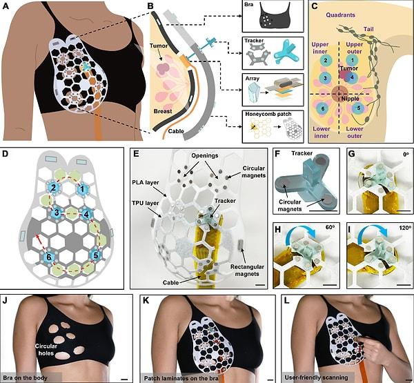 From Concept to Reality: The Wearable Ultrasound Scanner's Successful Trials and Potential in Breast Health Monitoring