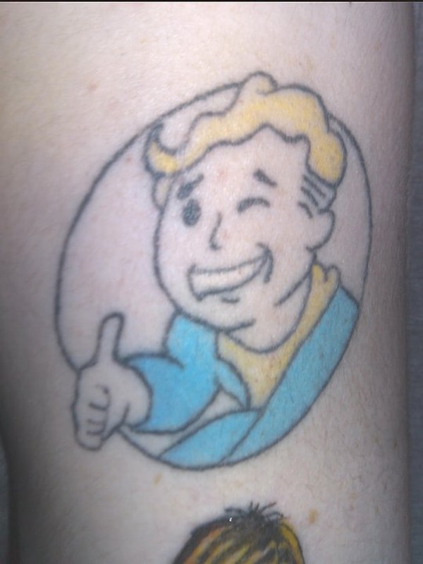 9. Bu Vault Boy'lar neden bu kadar acı çekiyor?