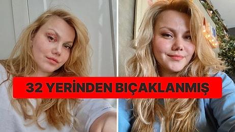 Ünlü YouTuber Merve Veziroğlu Yıldırım Eşinin Saldırısına Uğradı: 32 Yerinden Bıçaklanmış