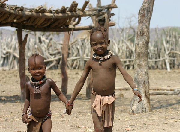 Kwashiorkor terimi, Jamaika kökenli pediatrist Cicely Williams tarafından literatüre kazandırılmıştır.