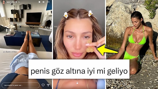 Penis Şeklindeki Buzla Göz Altındaki Şişlikleri İndirmeye Çalışan Şevval Şahin Beyinleri Yaktı
