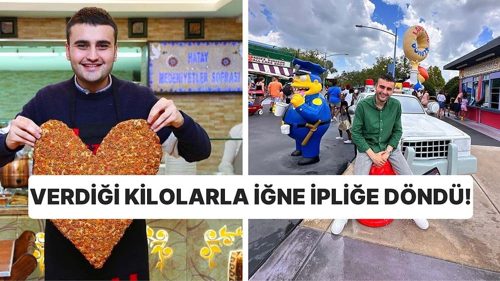 Zor Günler Geçiren CZN Burak, Verdiği Kilolarla Bir Deri Bir Kemik Kaldı!