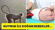 Neden Bazı İnsanlar Hayvanlar Gibi Kuyruklarla Doğar?