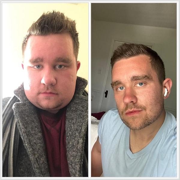 10. "45 kilo sonra yüzümdeki büyük değişim!"