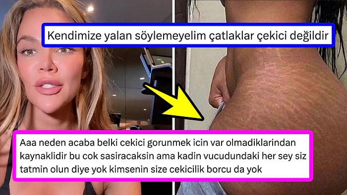 "Çatlaklar Çekici Değildir" Diyen Densize Ağzının Payını Veren Kişilerin Füze Gibi Cevapları