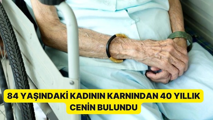 84 Yaşındaki Kadının Karnında 40 Yıllık Cenin Bulundu