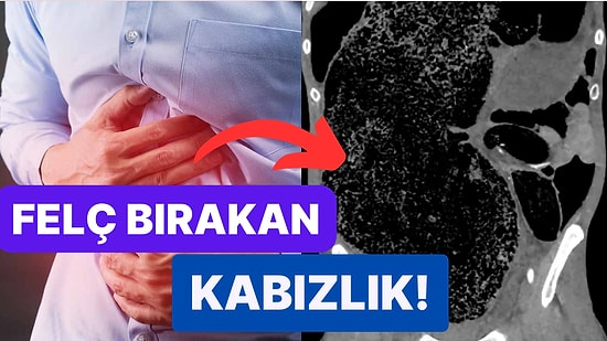 Kabızlık Şikayetiyle Hastaneye Giden Adamın Neredeyse Felç Kalmasına Yol Açan Rahatsızlığı