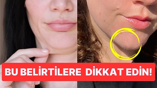 Kadınların Çenesinde Çıkan Tüyler Herhangi Bir Sağlık Sorunun Habercisi Olabilir mi?