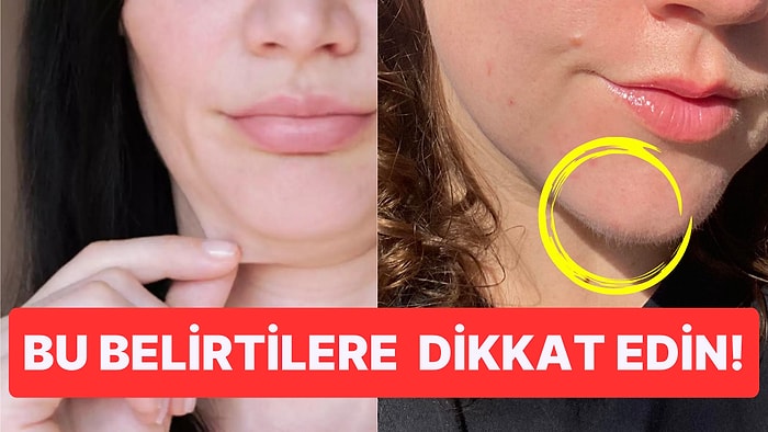 Kadınların Çenesinde Çıkan Tüyler Herhangi Bir Sağlık Sorunun Habercisi Olabilir mi?