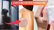 Vücut Sivilceleri Nasıl Geçer? Sırt Bacak Dekolte Bölgesi ve Kalçadaki Sivilcelerden Kurtulmak İçin Öneriler
