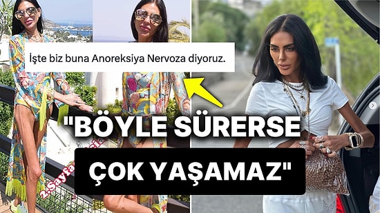 'Sağlıklıyım' Açıklaması Yapan Süreyya Yalçın'a Doktorlardan Çok Net ve Korkutan Yorumlar Geldi!