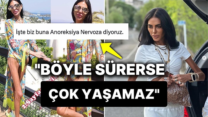 'Sağlıklıyım' Açıklaması Yapan Süreyya Yalçın'a Doktorlardan Çok Net ve Korkutan Yorumlar Geldi!