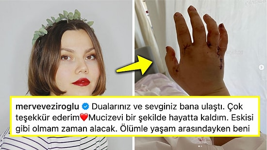 Eşi Tarafından 32 Yerinden Bıçaklanan ve Ölümden Dönen Ünlü Fenomen Merve Veziroğlu'dan İlk Paylaşım Geldi