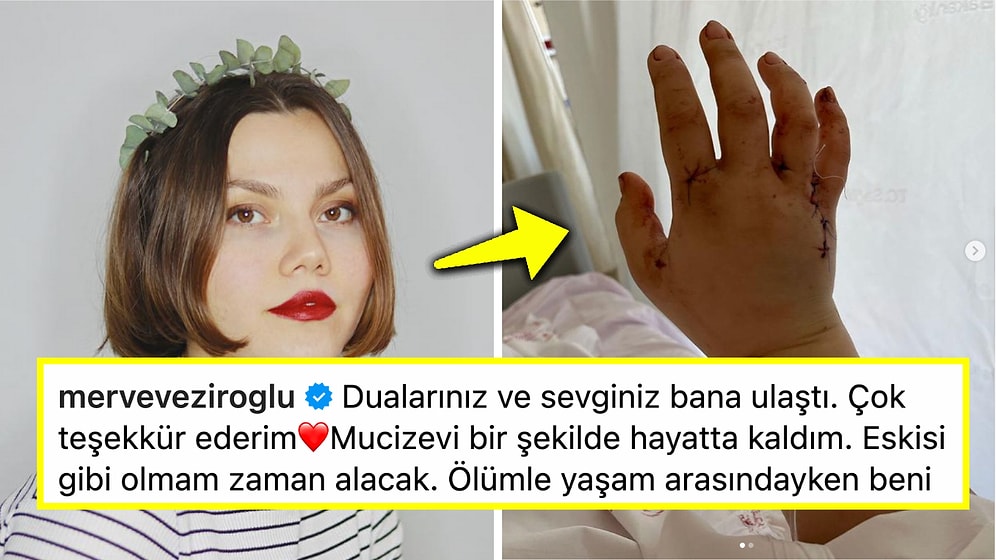 Eşi Tarafından 32 Yerinden Bıçaklanan ve Ölümden Dönen Ünlü Fenomen Merve Veziroğlu'dan İlk Paylaşım Geldi