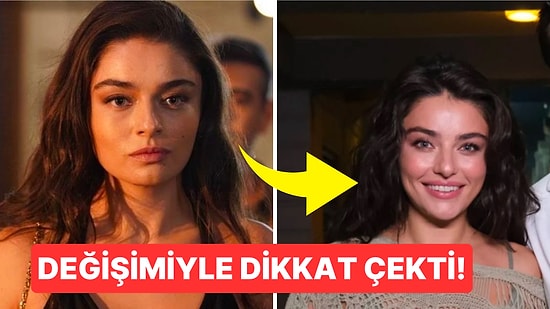 Ayça Ayşin Turan, Değişimiyle Görenleri Şaşırttı! Güzel Oyuncu, Estetikliler Kervanına mı Katıldı?